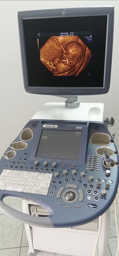 VOLUSON E8 EXPERT BT13 - HD LIVE