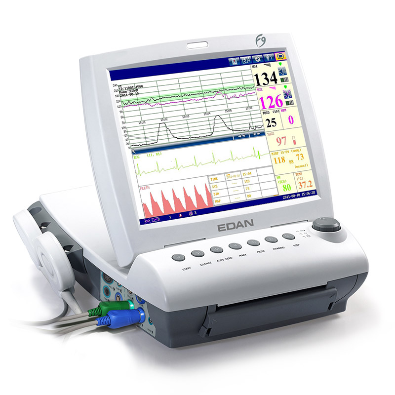 ΚΑΡΔΙΟΤΟΚΟΓΡΑΦΟΙ